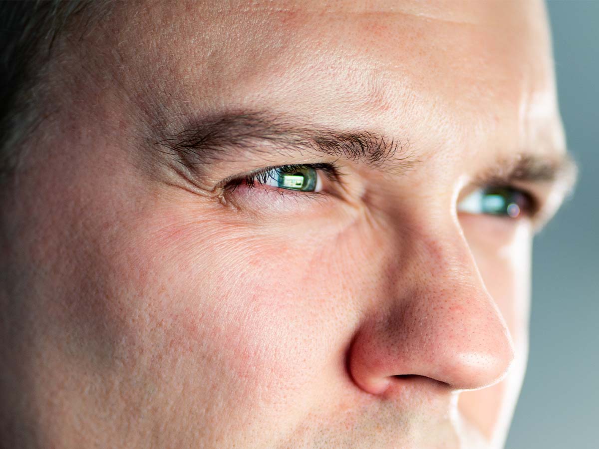 Ein Mann mit zusammengekniffenen Augen blickt konzentriert auf einen Bildschirm – sei es ein Laptop oder ein Handy. Das Licht des Geräts beleuchtet sein Gesicht, das angespannt wirkt. Auch beim Fernsehen oder bei der Arbeit ist seine schlechte Sicht deutlich zu erkennen. In der Nahaufnahme wird die Kurzsichtigkeit (Myopie) des Mannes besonders sichtbar.